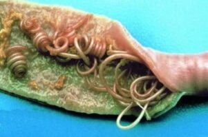 Lombrices intestinales