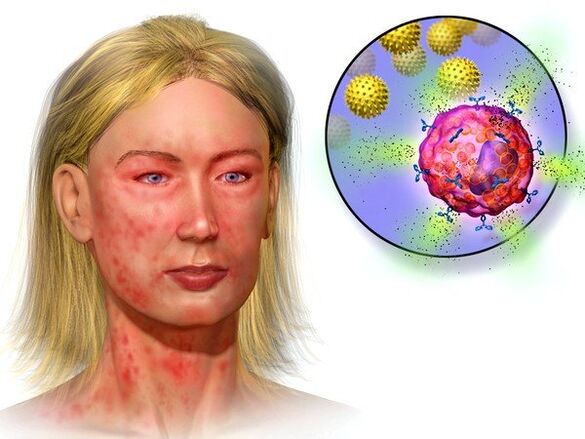 Equinococos y síntomas de su presencia en el cuerpo.