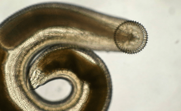 gnatostoma parásito subcutáneo