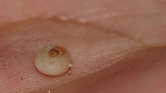 sarcopsilosis con parásitos subcutáneos